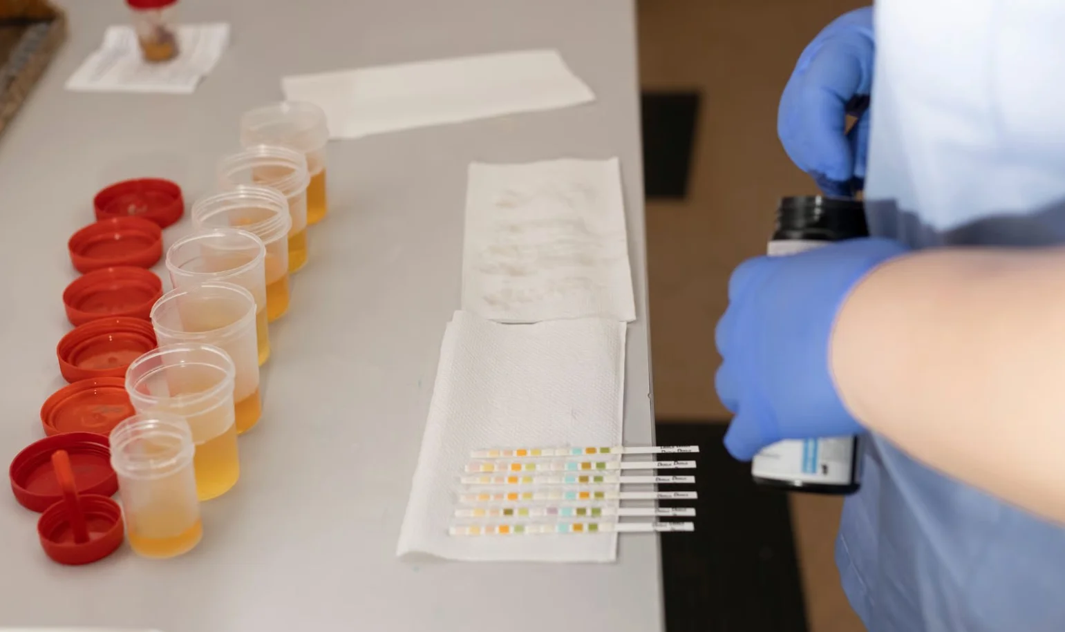 How Long Can Alcohol Be Detected in Urine EtG